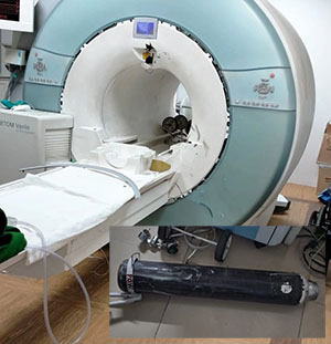 MRI Accident